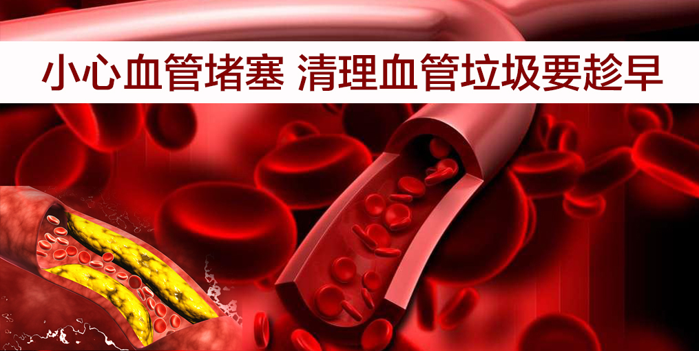 當(dāng)心！這幾類人群血管最易堵，適當(dāng)補(bǔ)硒遠(yuǎn)離血管疾病