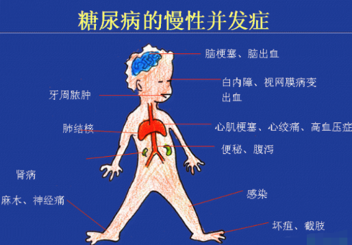 你還在害怕糖尿病嗎?科學(xué)補硒不“恐糖”