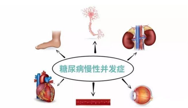 血糖波動大，并發(fā)癥來得快，糖友要多補硒